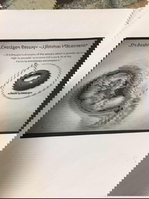 Disini ada ibu2 yang pernah atau sedang menggunakan arabin cerclage?