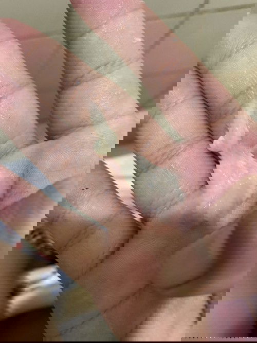 Di ko alm if mocus plug siya