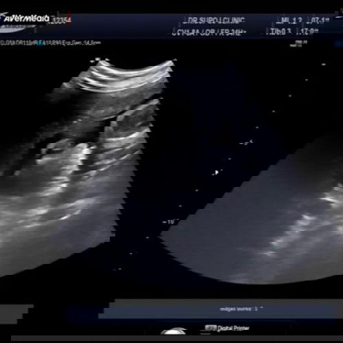 อยากถามแม่ๆค่ะ