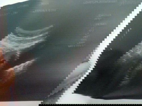 ขอคำแนะนำหน่อยค่ะ