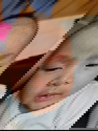 Kulit kering