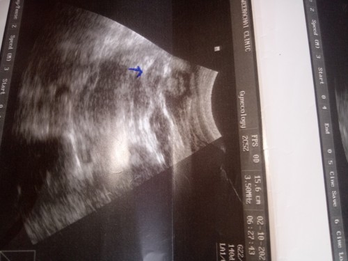 แม่ๆคนไหนพอจะดูออกบ้างว่าเพศหญิงหรือชายค่ะ