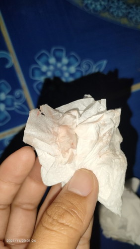 ปวดเยี่ยวเลยลุกขึ้นมาเยี่ยวในเวลาตีหนึ่งครึ่งเยี่ยวเสร็จรู้สึกเจ็บท้องน้อยจีดประมาณ10วินาที