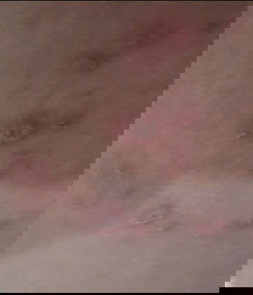 Luka yg tak di sangka