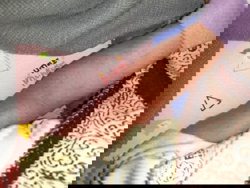 Bintik" merah d kulit