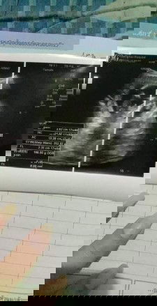 17 Wแม่ๆช่วยดูผล ซาวด์หน่อยจ้า #ผู้ชายชายรึผู้หญิงนร้า