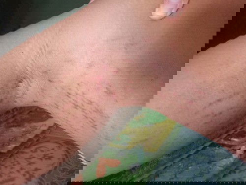 แม่ๆคนไหนประสบปัญหาแบบนี้บ้างค่ะ