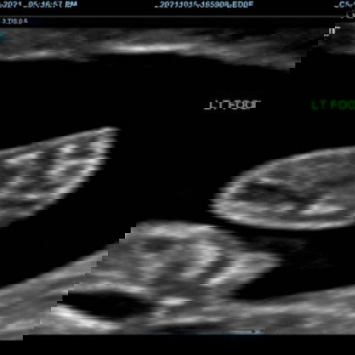 Tapak kaki kiri anak pertama ibu.. ❤👶🏻