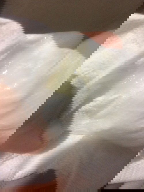 ตั้งครรภ์39+1มีมูกสีขุ่นออกมาเยอะ