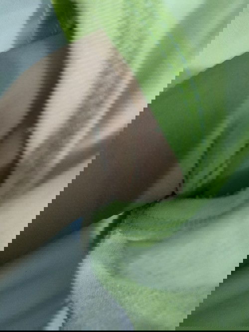 Lipatan pada ketiak dan paha berwarna hitam