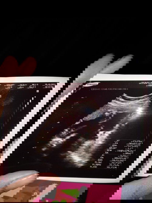 มองภาพอัลตร้าซาวด์