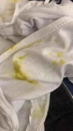 DILAW NA PGSUKA NI BABY, ANO ANG DAHILAN?