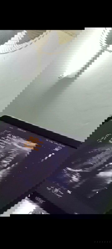 คุณหมอบอกว่าหนูเป็นผู้หญิง