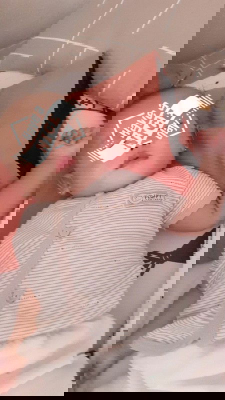 Warna kulit tidak rata