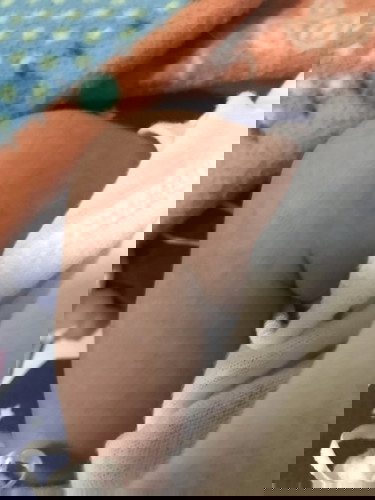 naworry po ako ano po kaya itong nasa balat ni baby . boung katawan niya po ganito .