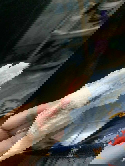 วันนี้ไปหาหมอปากมดลูกเปิด 2 เซน ถามแม่ๆหน่อยค่ะ