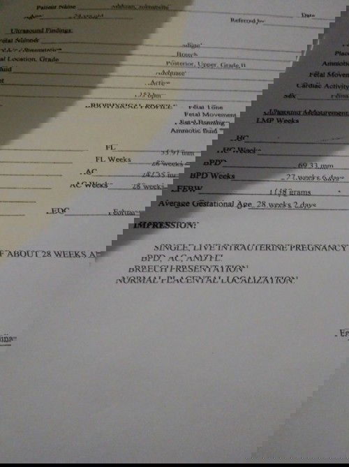 #babyintrauterinepregnancy