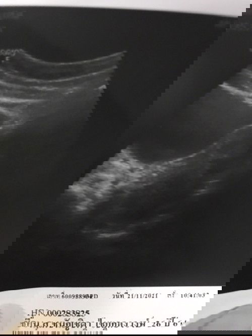 ซาวร์ครั้งแรกไม่เจอค่ะ กังวนมาก