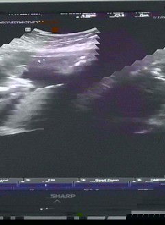 ยังมีโอกาสเป็นเด็กหญิงอยู่ไหม