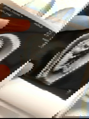 อยากรู้เพศต้องรอกี่เดือนคะ