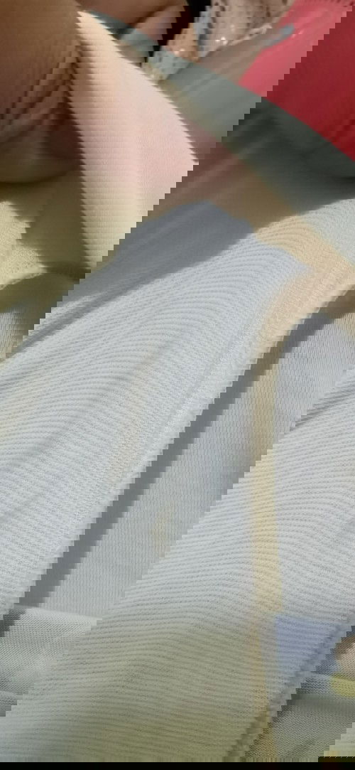 Hi po ask ko po sana kung ano to medyo confuse po ksi ako sa color pag gising ko po ngayn morning.