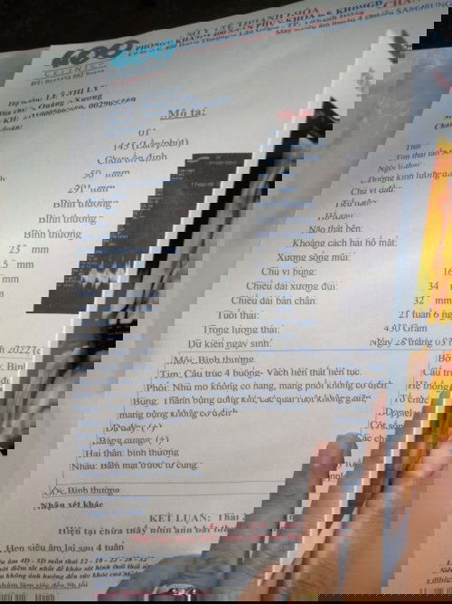 Hổ đực tháng 3