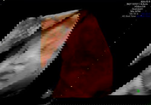 E là Bon bánh bao ạ