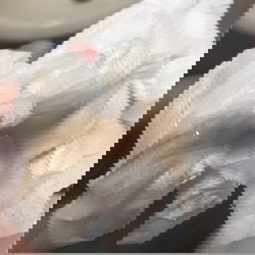 #ผ่าคลอด #แม่หลังคลอด