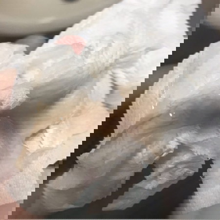#ผ่าคลอด #แม่หลังคลอด