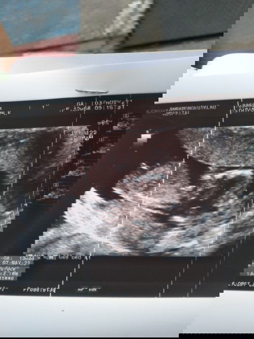 สอบถามหน่อยคะ