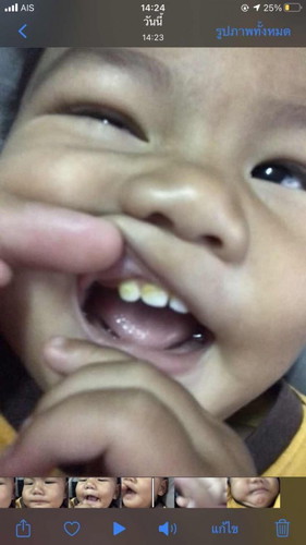 ขอคำปรึกษาบอกวิธีรักษาให้หายหน่อยคะ