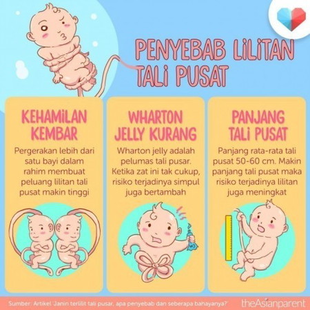 Penyebab Lilitan Tali Pusar