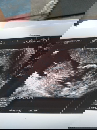 รบกวนสอบถาม