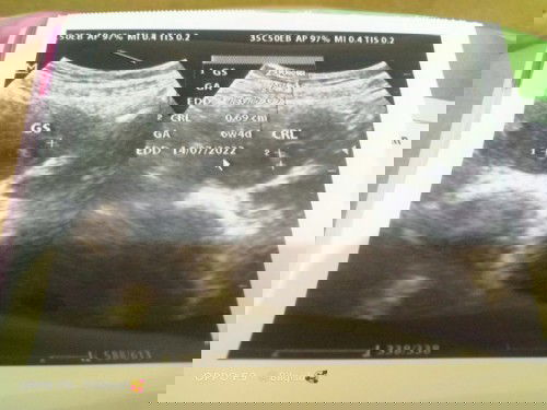 Hamil ke 2 tp tidak merasakan apa²