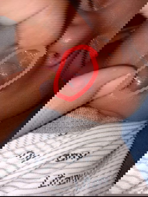 Putih putih dibibir dan lidah