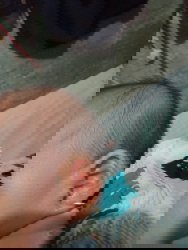 Telinga anak saya habis di tindik