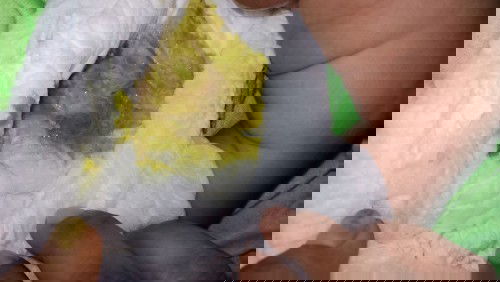 Oup bayinada bercak darah