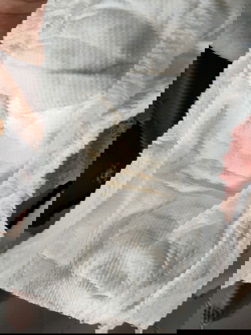 Is this pee colour normal?