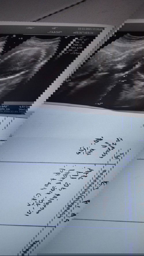 Perkiraan jnis kelamin