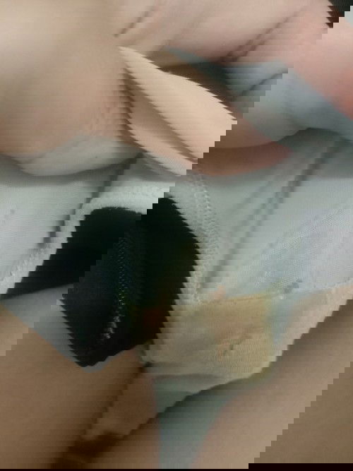 อยากทราบว่าท้อง 7 วีคแล้วค่ะ แบบนี้คืออะไรคะ มันปกติไหมคะเพราะปวดท้องน้อยมากเลยค่ะ