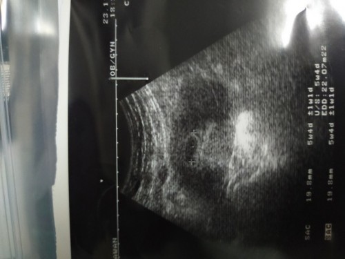 Scan kandungan (2buln)