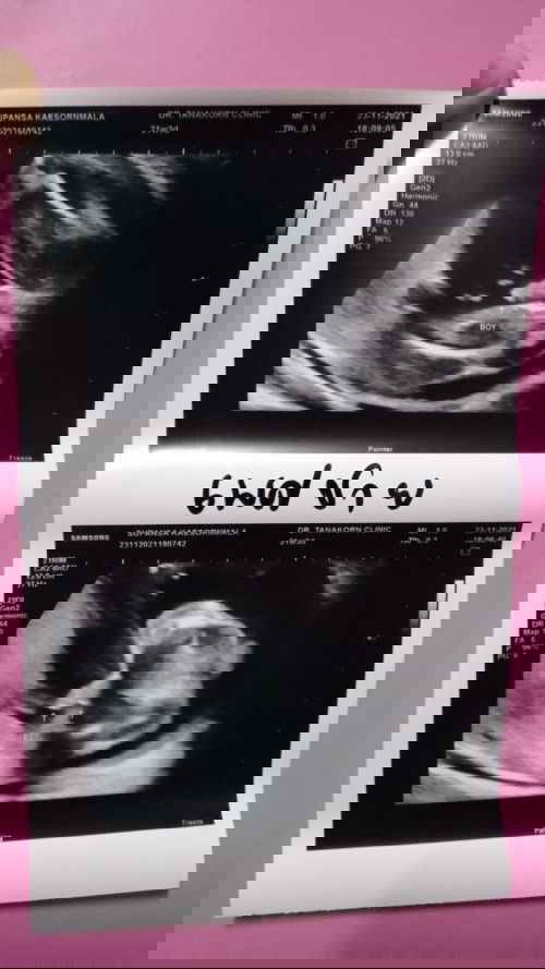 ทนไม่ไหว ไปซาวด์ใหม่อีกรอบ