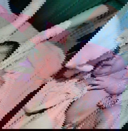 บันทึกการคลอดโดยการบล็อกหลังของฉัน