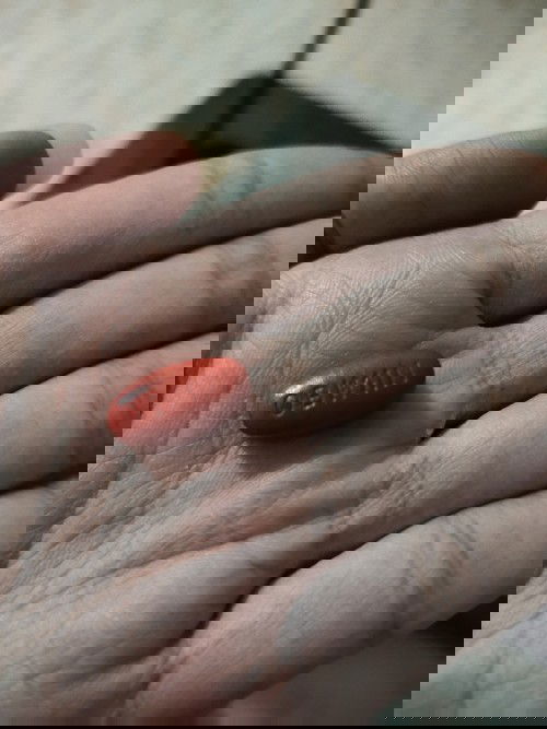 กินยาบำรุงซ้ำ อันตรายไหม