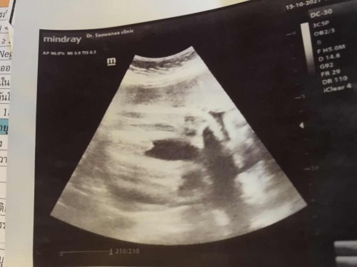 แม่ๆดูให้หน่อยค่ะ แบบนี้ ญ/ช