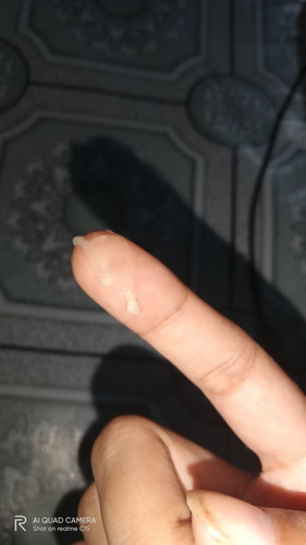 Normal Discharge ba ito?