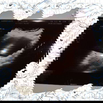 Hamil 9w janin belum terlihat