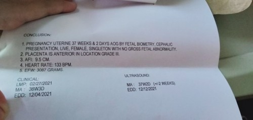 normal lang poba?