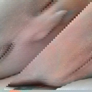 Cara mengatasi mata berair dan ada putih2nya