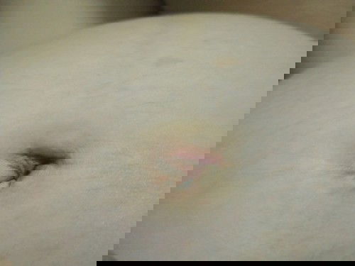 ทำมัยสะดือถึงดำ